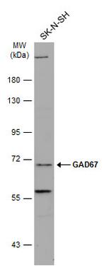 GAD67 Antibody in Western Blot (WB)