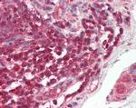 c-Rel Antibody in Immunohistochemistry (Paraffin) (IHC (P))