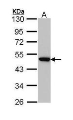 AP2M1 Antibody in Western Blot (WB)