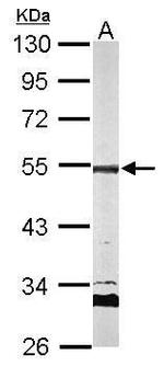 AP2M1 Antibody in Western Blot (WB)