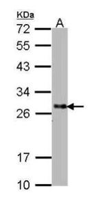 SNAP25 Antibody in Western Blot (WB)