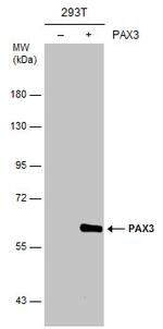 PAX3 Antibody in Western Blot (WB)