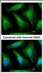 TUBA1A Antibody in Immunocytochemistry (ICC/IF)