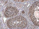 TUBA1A Antibody in Immunohistochemistry (Paraffin) (IHC (P))