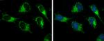 ACAA2 Antibody in Immunocytochemistry (ICC/IF)