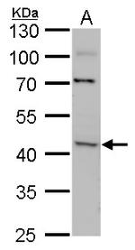 ACAA2 Antibody in Western Blot (WB)