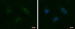 HELIOS Antibody in Immunocytochemistry (ICC/IF)