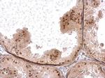 HELIOS Antibody in Immunohistochemistry (Paraffin) (IHC (P))