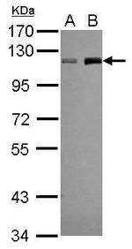 LSD1 Antibody in Western Blot (WB)