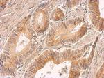 IL-8 (CXCL8) Antibody in Immunohistochemistry (Paraffin) (IHC (P))