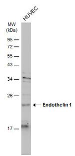 Endothelin 1 Antibody in Western Blot (WB)