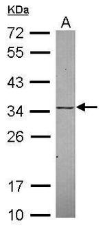 KChIP2 Antibody in Western Blot (WB)