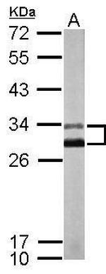 KChIP2 Antibody in Western Blot (WB)