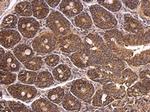 DAB1 Antibody in Immunohistochemistry (Paraffin) (IHC (P))