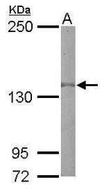 EGFR Antibody in Western Blot (WB)