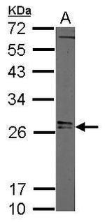 LIN28A Antibody in Western Blot (WB)