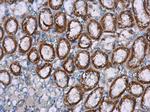 NOX4 Antibody in Immunohistochemistry (Paraffin) (IHC (P))