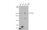 TET2 Antibody in Western Blot (WB)