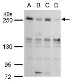 TET2 Antibody in Western Blot (WB)