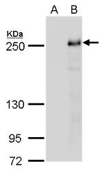 TET2 Antibody in Western Blot (WB)