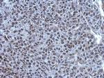 TET1 Antibody in Immunohistochemistry (Paraffin) (IHC (P))