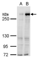 TET1 Antibody in Western Blot (WB)