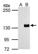 TLR7 Antibody in Western Blot (WB)