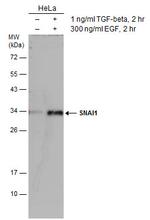 SNAIL Antibody in Western Blot (WB)