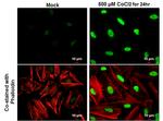 HIF1A Antibody in Immunocytochemistry (ICC/IF)