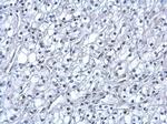 HIF1A Antibody in Immunohistochemistry (Paraffin) (IHC (P))