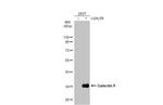 Galectin 9 Antibody in Western Blot (WB)