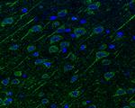 Neuropilin 1 Antibody in Immunohistochemistry (Paraffin) (IHC (P))