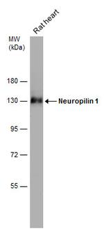 Neuropilin 1 Antibody in Western Blot (WB)