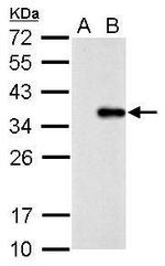 COL11A2 Antibody in Western Blot (WB)