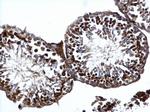 ATR Antibody in Immunohistochemistry (Paraffin) (IHC (P))