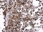 Phospho-CDK1 (Tyr15) Antibody in Immunohistochemistry (Paraffin) (IHC (P))