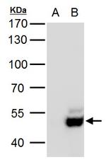 USP3 Antibody in Western Blot (WB)