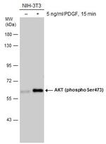 Phospho-AKT1 (Ser473) Antibody in Western Blot (WB)