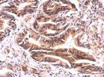 ATG9A Antibody in Immunohistochemistry (Paraffin) (IHC (P))