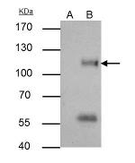 ATG9A Antibody in Immunoprecipitation (IP)