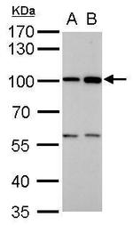 ATG9A Antibody in Western Blot (WB)
