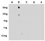 5-Methylcytosine Antibody in Dot Blot (DB)