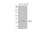 AKT2 Antibody in Western Blot (WB)