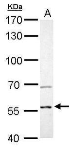 AKT2 Antibody in Western Blot (WB)