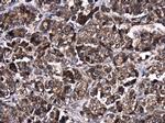 AKT2 Antibody in Immunohistochemistry (Paraffin) (IHC (P))