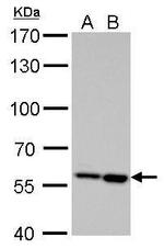 AKT2 Antibody in Western Blot (WB)