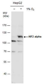 HIF-2 alpha Antibody in Western Blot (WB)