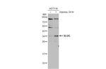 SLUG Antibody in Western Blot (WB)