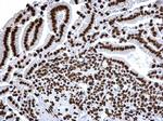 H3K18ac Antibody in Immunohistochemistry (Paraffin) (IHC (P))