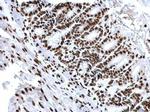 H3K18ac Antibody in Immunohistochemistry (Paraffin) (IHC (P))